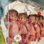 تولد نوزادان ۵قلو در گچساران