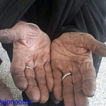 روستایی در کهگیلویه که مردمش حتی سرویس بهداشتی ندارند!